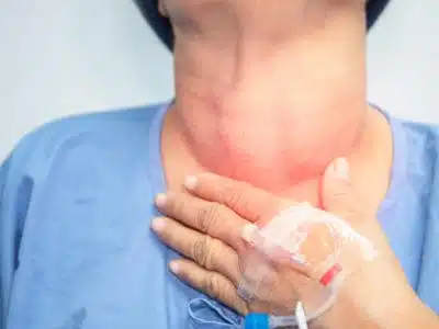 Ablation de la thyroïde