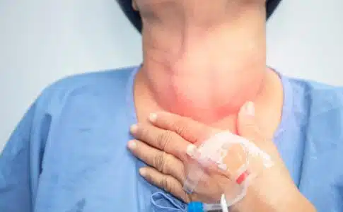 Ablation de la thyroïde